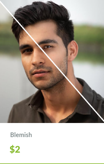 AddOns PhotoRetouch Blemish